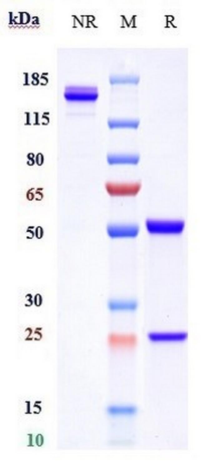 CD4 (Tregalizumab Biosimilar) Antibody in SDS-PAGE (SDS-PAGE)