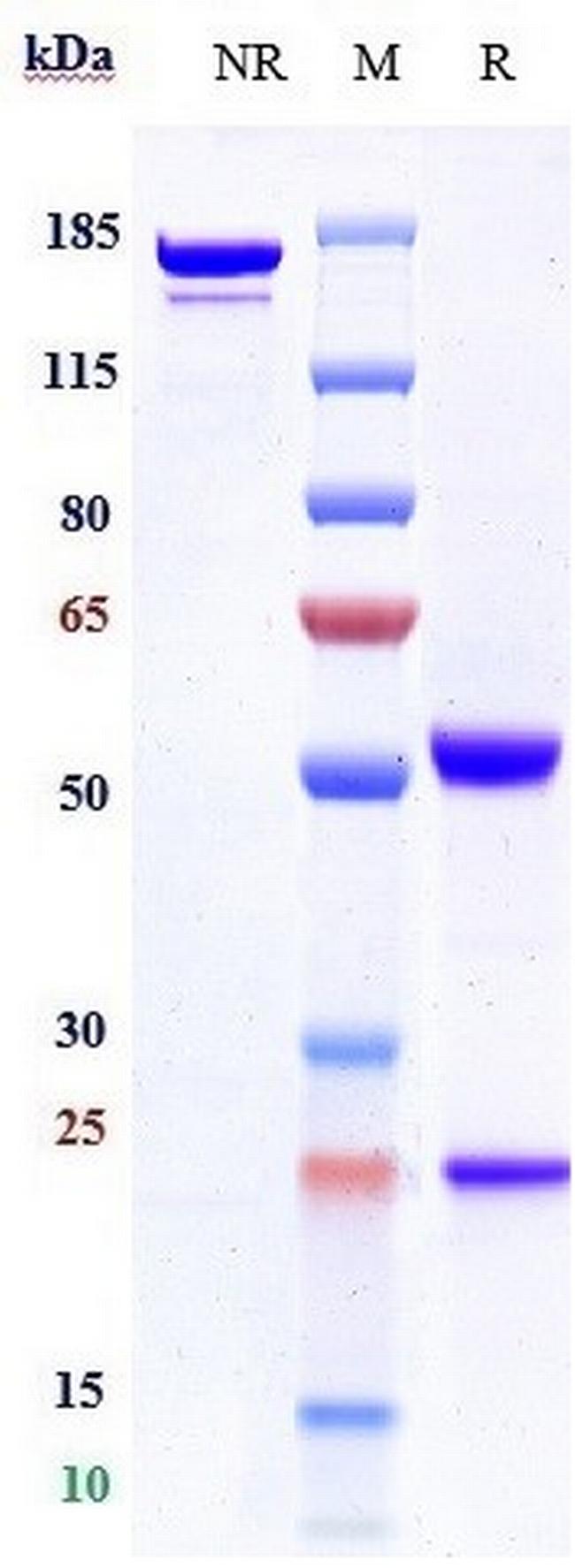 CD4 Humanized Biosimilar Antibody in SDS-PAGE (SDS-PAGE)