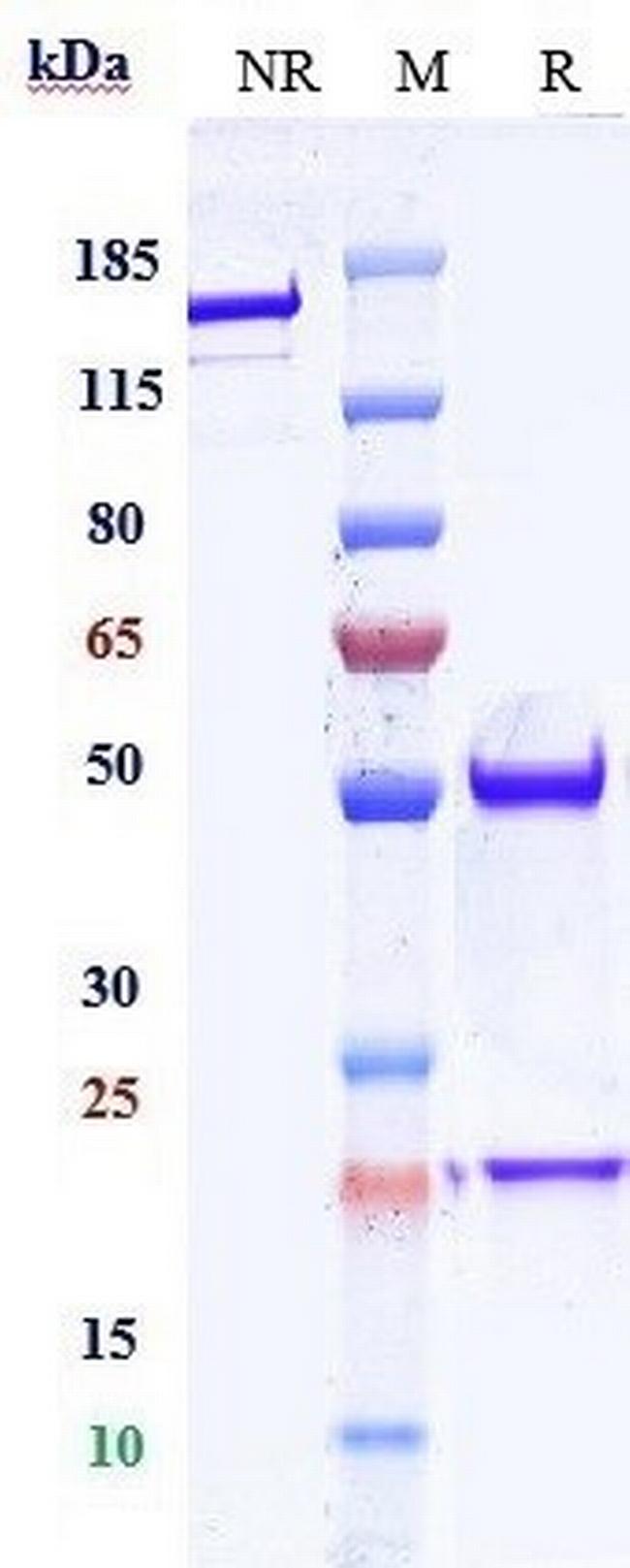 VEGF Biosimilar Antibody in SDS-PAGE (SDS-PAGE)