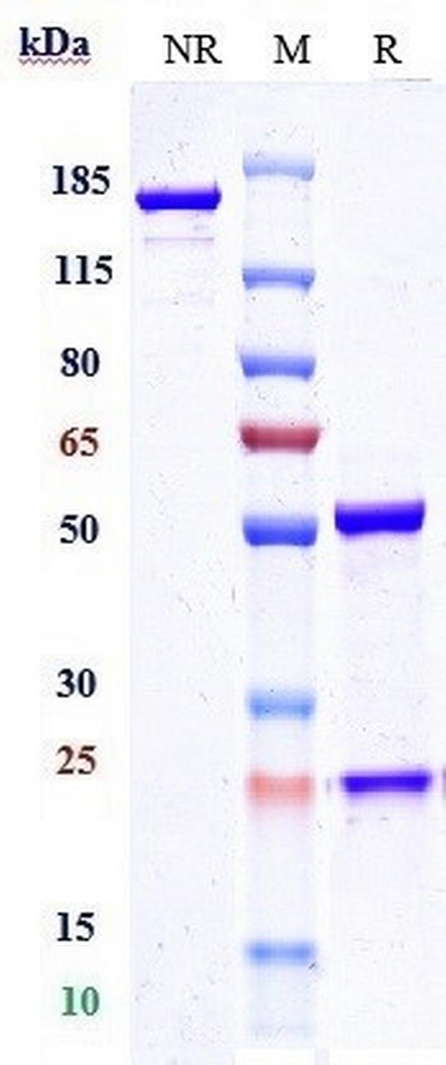 CD52 (Gatralimab Biosimilar) Antibody in SDS-PAGE (SDS-PAGE)