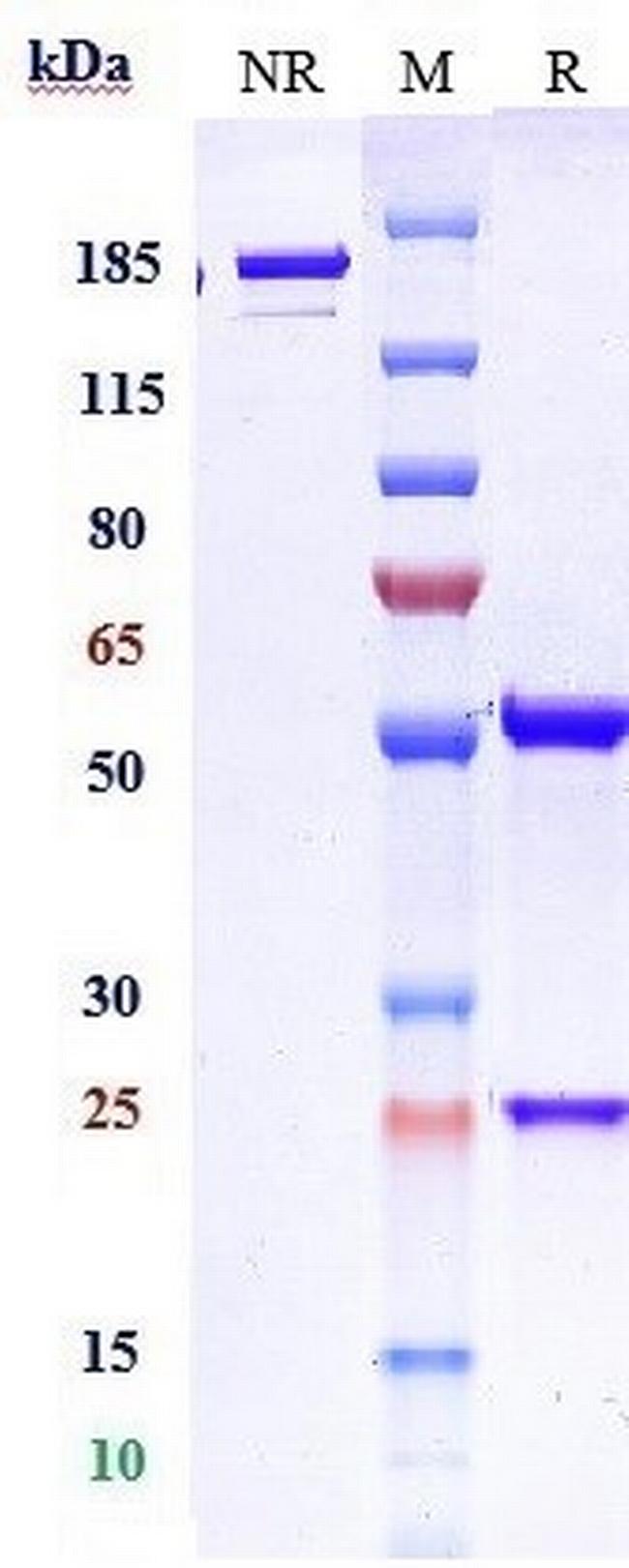TIGIT (Domvanalimab Biosimilar) Antibody in SDS-PAGE (SDS-PAGE)