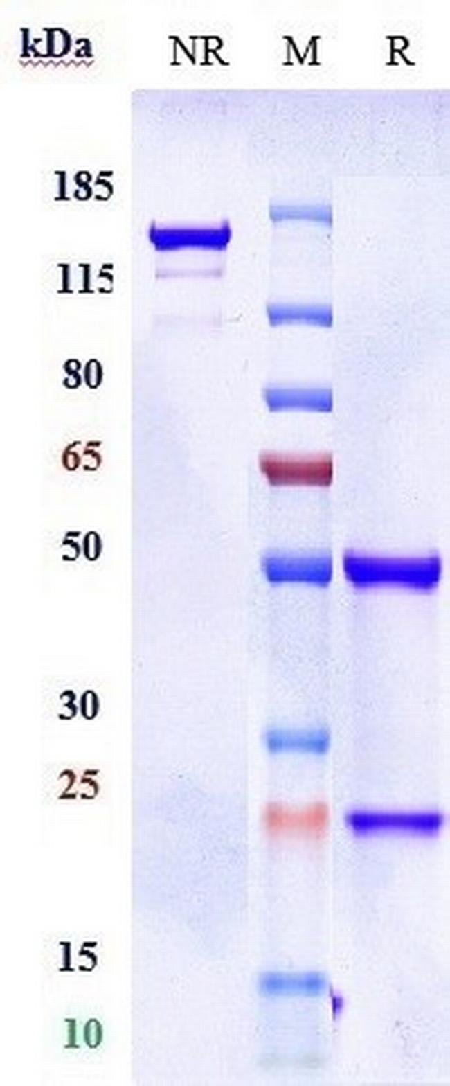 beta Amyloid (Donanemab Biosimilar) Antibody in SDS-PAGE (SDS-PAGE)