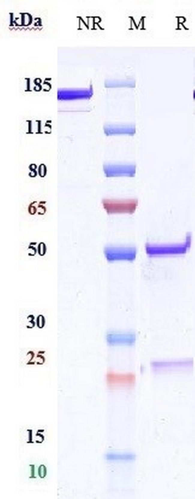 CD83 Humanized Biosimilar Antibody in SDS-PAGE (SDS-PAGE)