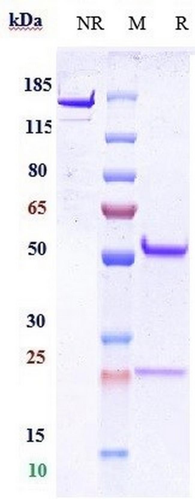 CD9 Biosimilar Antibody in SDS-PAGE (SDS-PAGE)