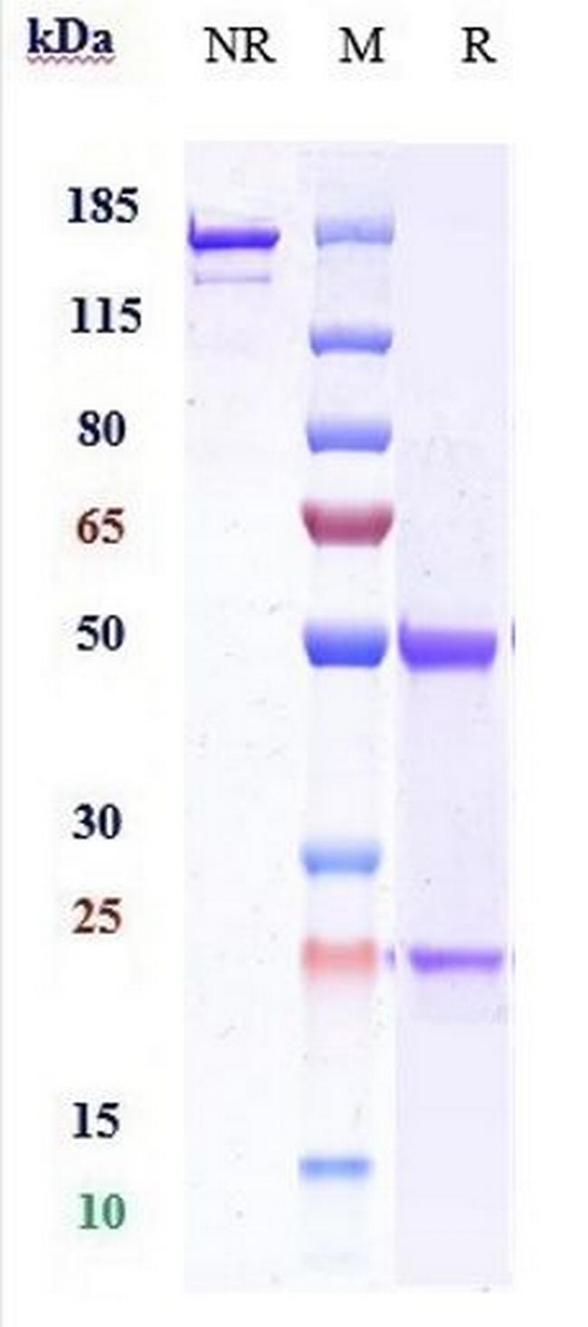 C5AR1 Humanized Biosimilar Antibody in SDS-PAGE (SDS-PAGE)