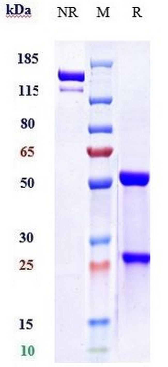 PCSK9 (Evolocumab Biosimilar) Antibody in SDS-PAGE (SDS-PAGE)