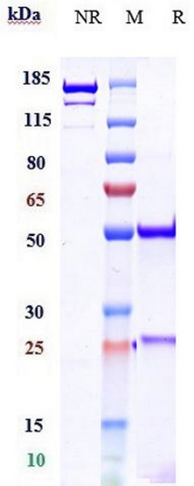 IL-17A Biosimilar Antibody in SDS-PAGE (SDS-PAGE)