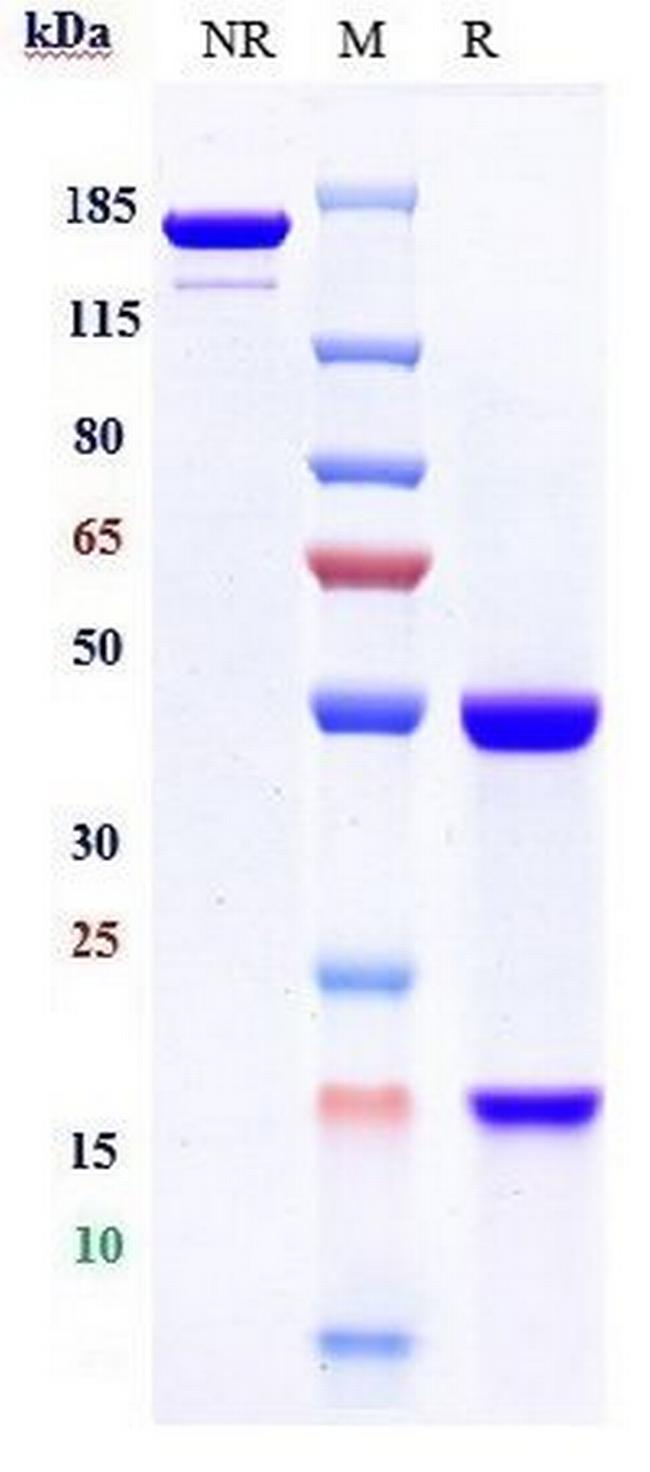 IL-17A (Perakizumab Biosimilar) Antibody in SDS-PAGE (SDS-PAGE)