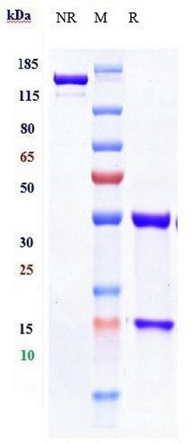 IL-17A (Vunakizumab Biosimilar) Antibody in SDS-PAGE (SDS-PAGE)