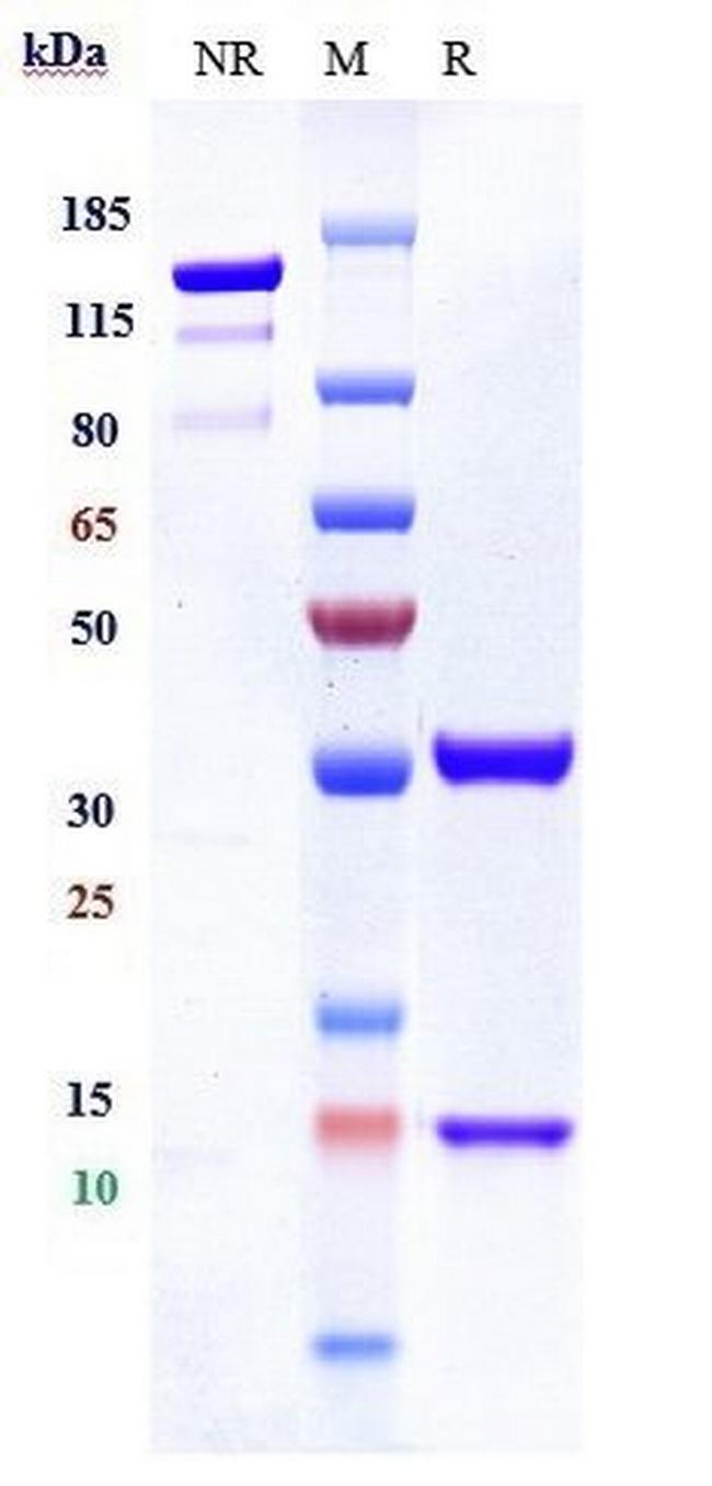 IL-8 (Biosimilar) Antibody in SDS-PAGE (SDS-PAGE)