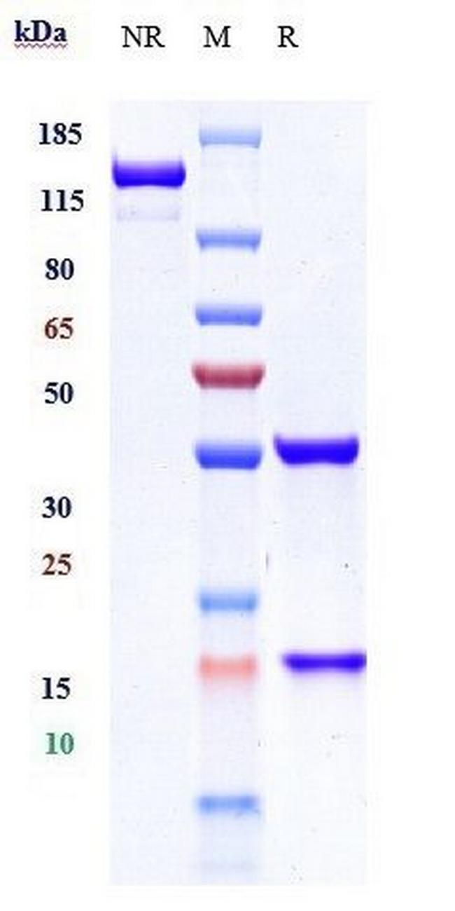 IL-1 beta (Gevokizumab Biosimilar) Antibody in SDS-PAGE (SDS-PAGE)