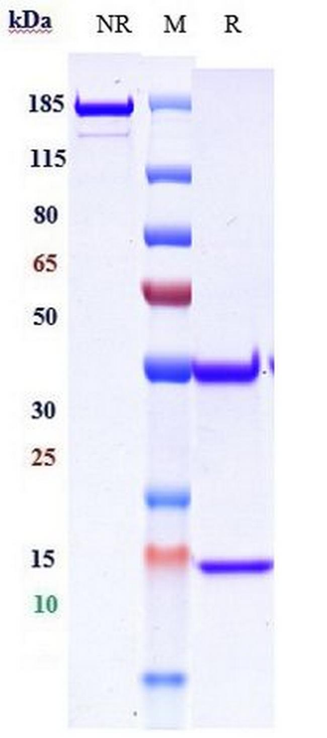 Demupitamab Antibody in SDS-PAGE (SDS-PAGE)