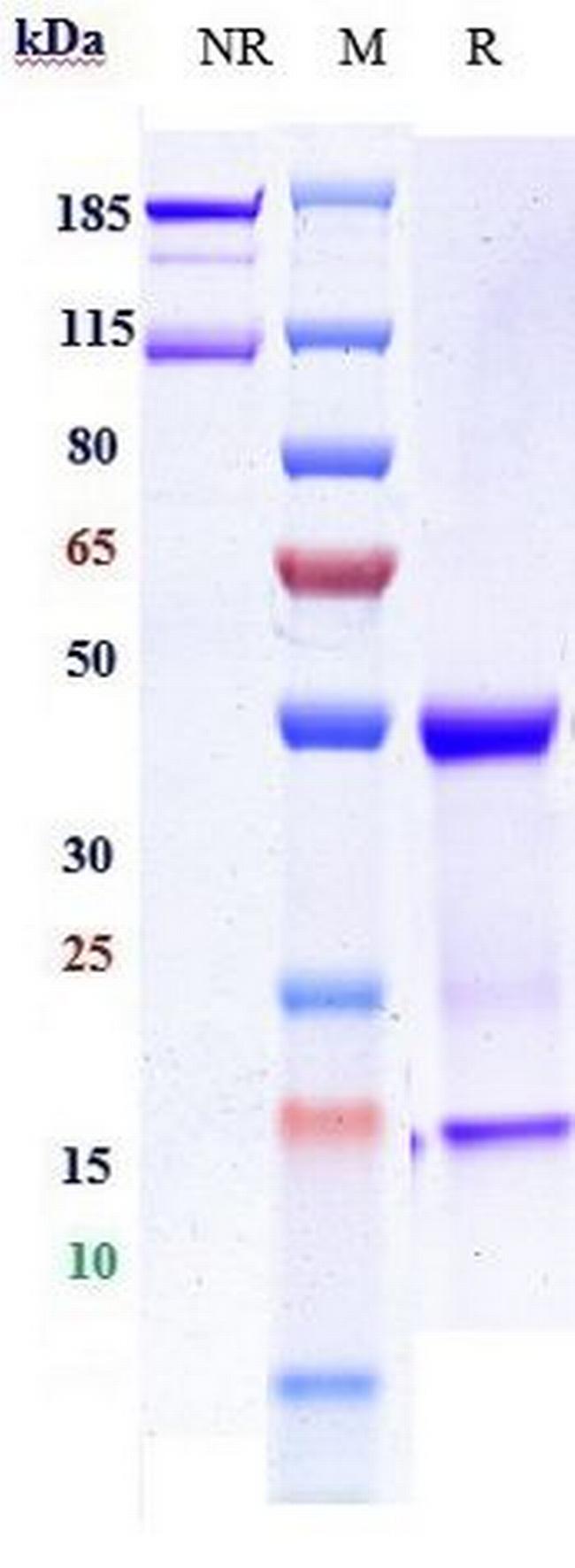 EGFR (Imgatuzumab Biosimilar) Antibody in SDS-PAGE (SDS-PAGE)