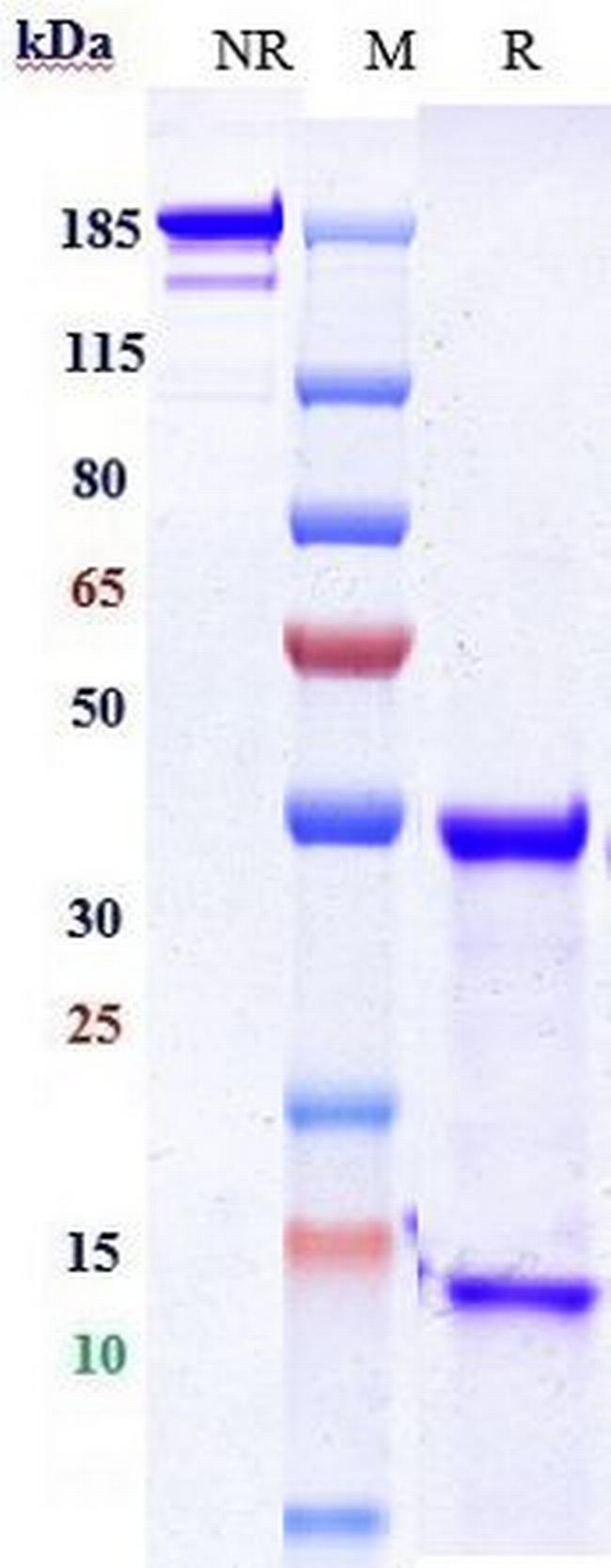 EGFR (Matuzumab Biosimilar) Antibody in SDS-PAGE (SDS-PAGE)
