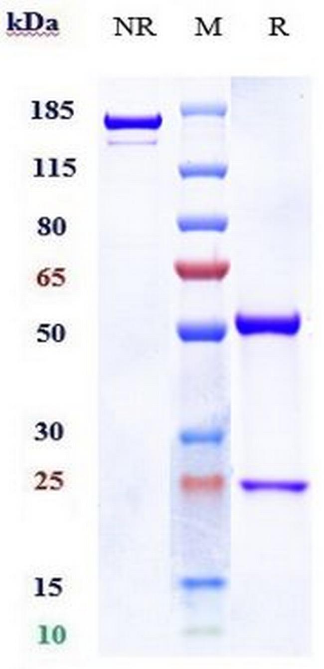 EGFR (Serclutamab Biosimilar) Antibody in SDS-PAGE (SDS-PAGE)