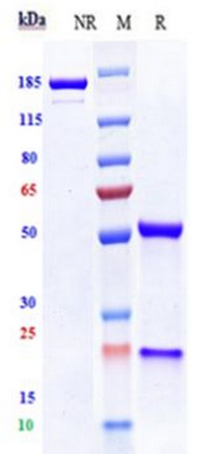 FLK1 (VEGF Receptor 2) (Biosimilar) Antibody in SDS-PAGE (SDS-PAGE)