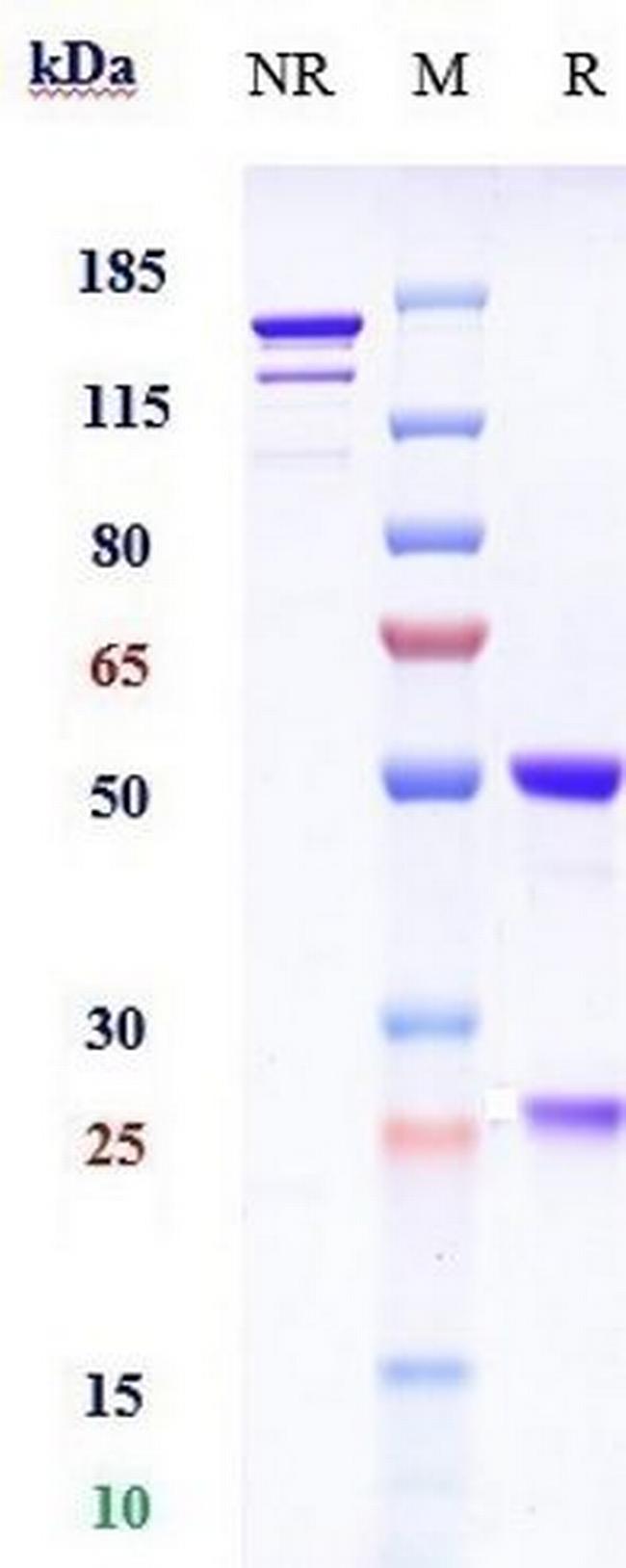 Abelacimab Antibody in SDS-PAGE (SDS-PAGE)