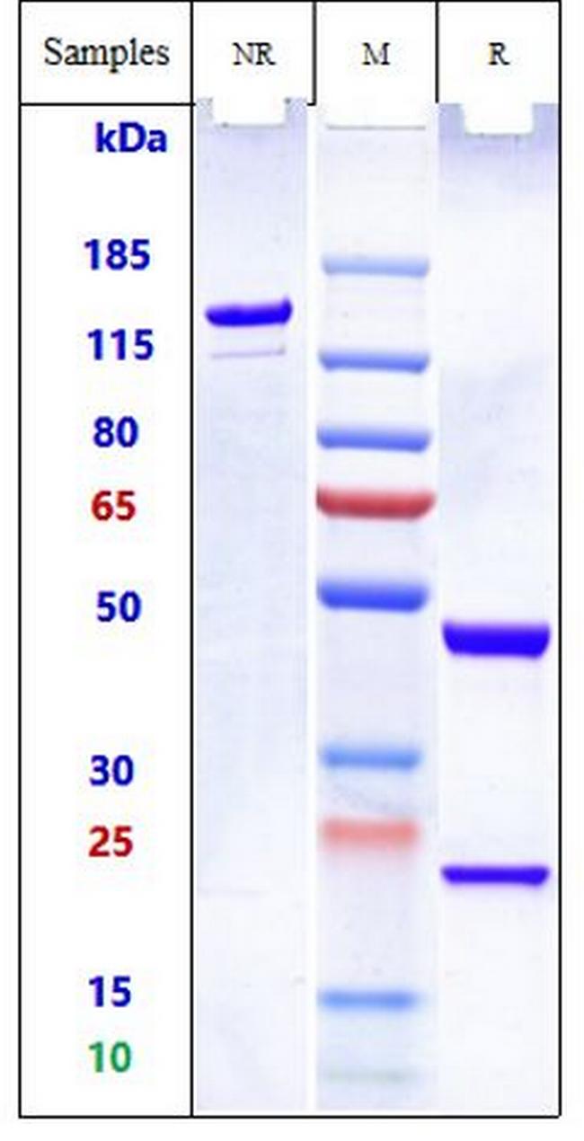 PSMA (Pelgifatamab Biosimilar) Antibody in SDS-PAGE (SDS-PAGE)