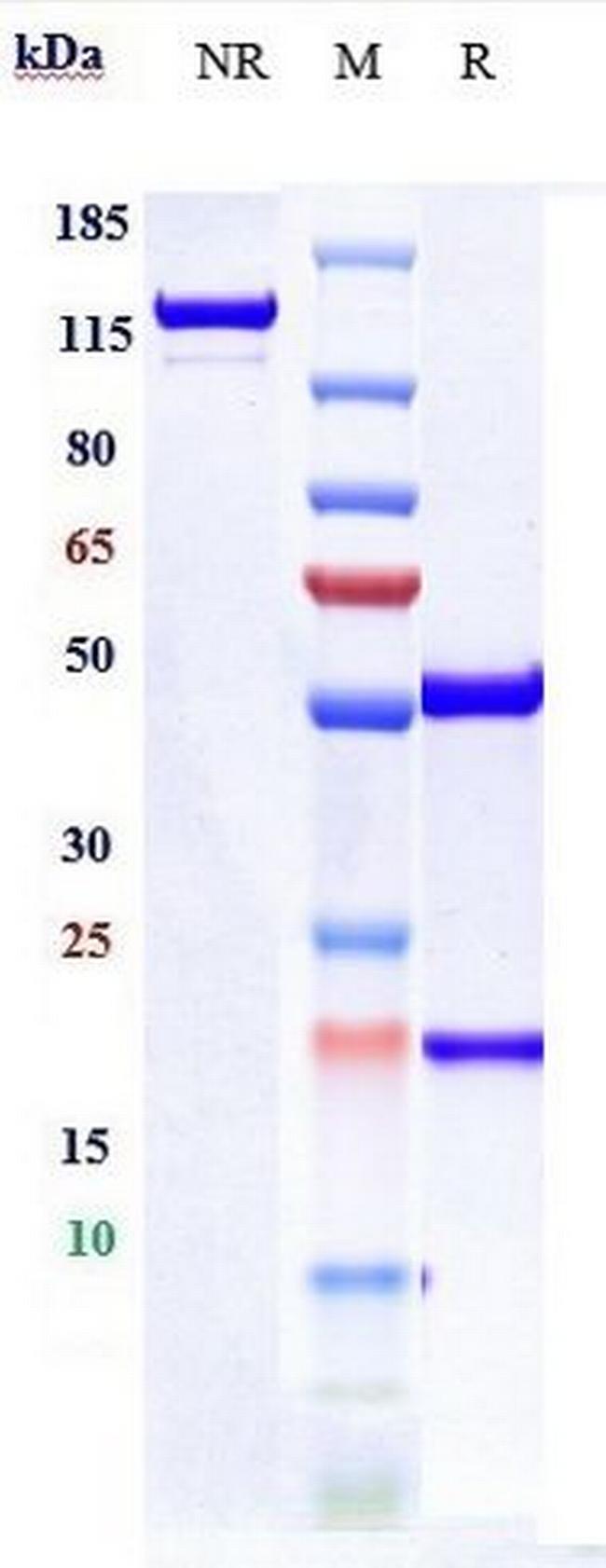 GITR (Biosimilar) Antibody in SDS-PAGE (SDS-PAGE)