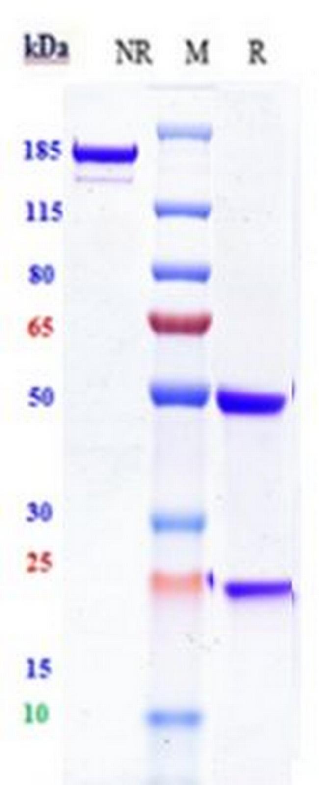 CD19 (Loncastuximab Biosimilar) Antibody in SDS-PAGE (SDS-PAGE)