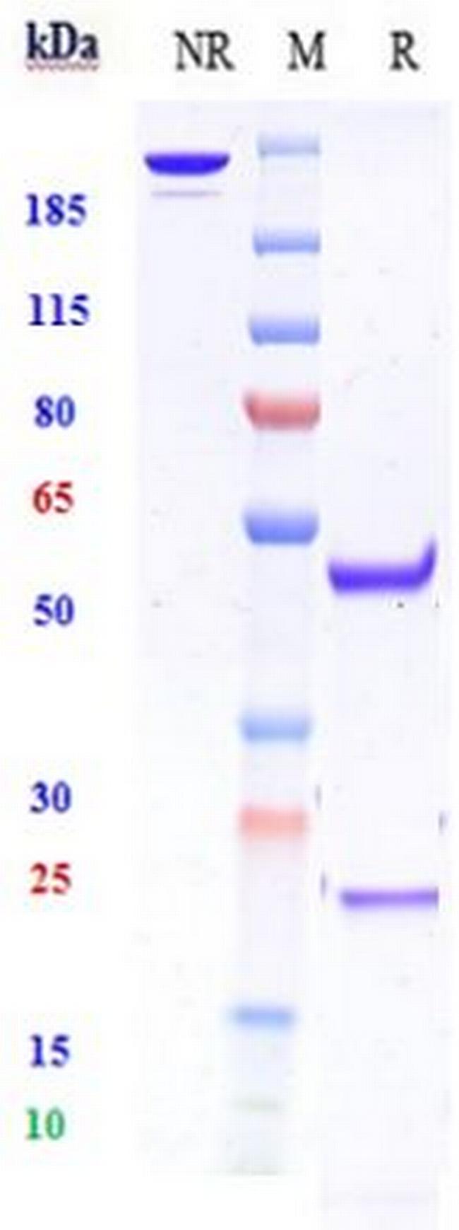 ZNF354C Biosimilar Antibody in SDS-PAGE (SDS-PAGE)