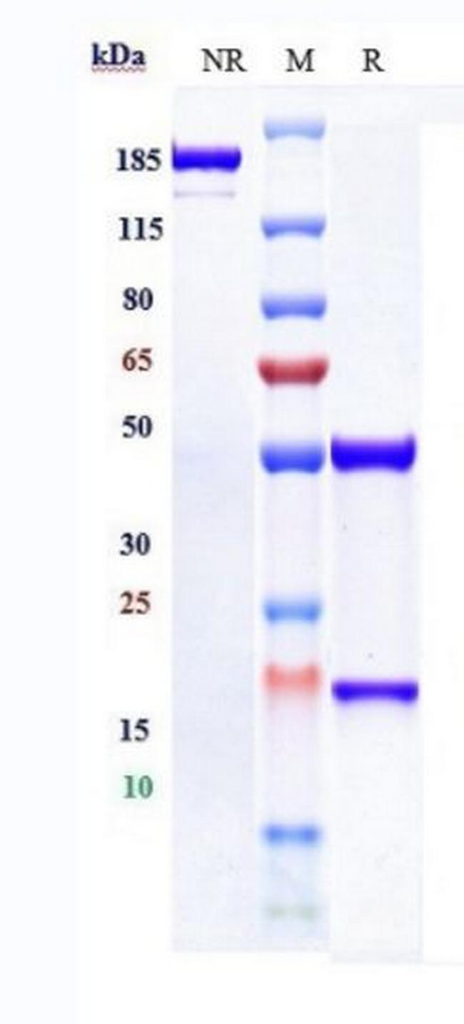 c-Met Biosimilar Antibody in SDS-PAGE (SDS-PAGE)