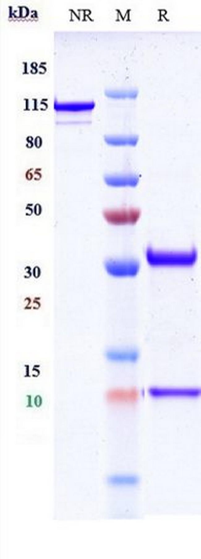 EGFR (Nimotuzumab Biosimilar) Antibody in SDS-PAGE (SDS-PAGE)
