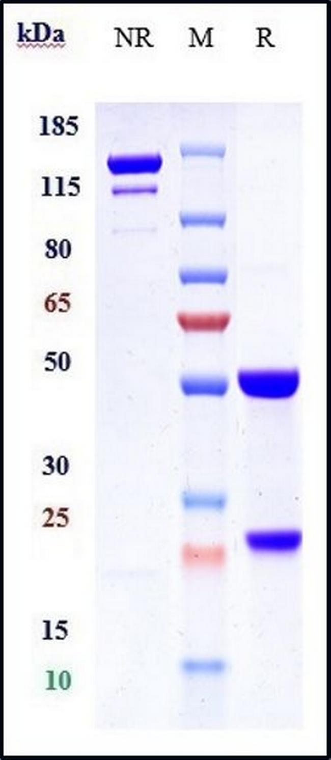 IL-12/IL-23 p40 (Briakinumab Biosimilar) Antibody in SDS-PAGE (SDS-PAGE)