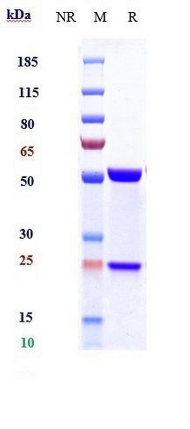 IL-21 (Avizakimab Biosimilar) Antibody in SDS-PAGE (SDS-PAGE)