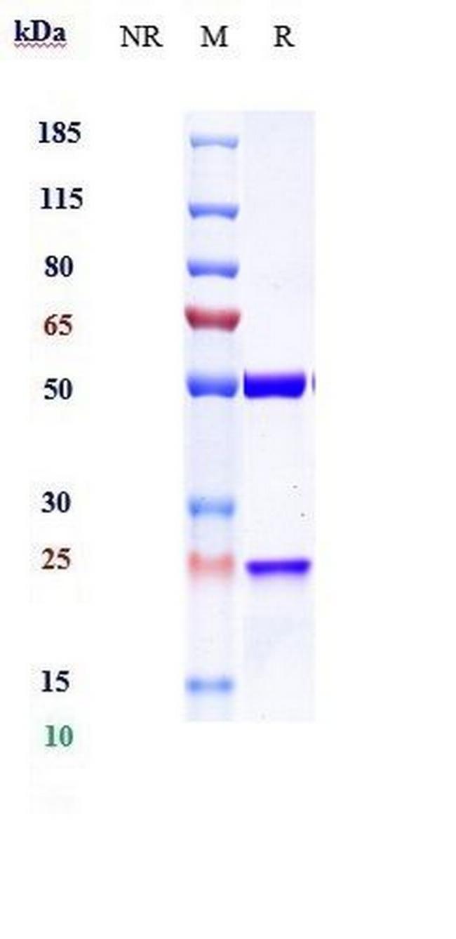 TIGIT (Ociperlimab Biosimilar) Antibody in SDS-PAGE (SDS-PAGE)