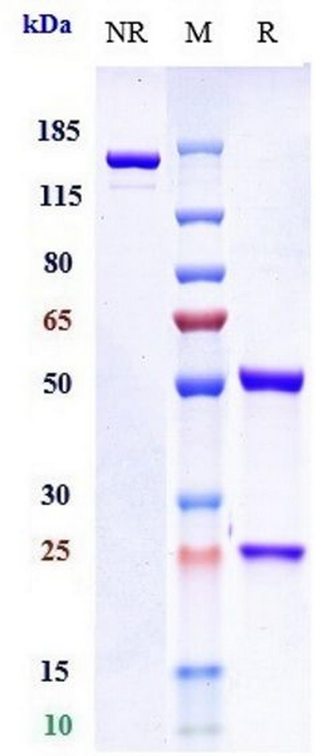 IL4R Biosimilar Antibody in SDS-PAGE (SDS-PAGE)