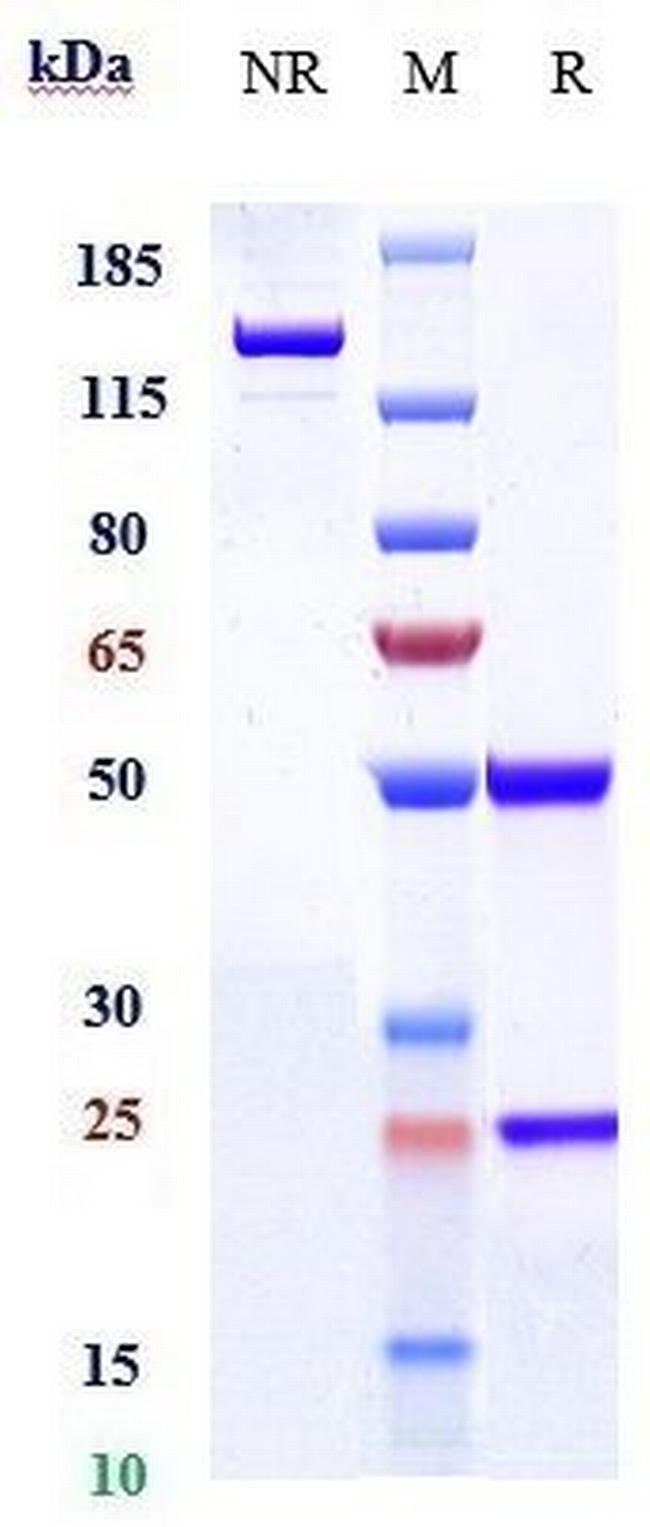 IL-5 (Mepolizumab Biosimilar) Antibody in SDS-PAGE (SDS-PAGE)