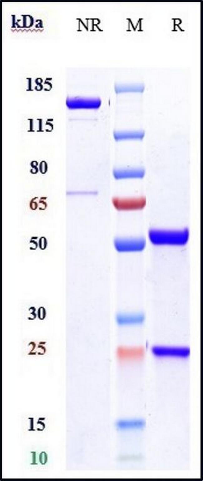 Oxidized LDL (Biosimilar) Antibody in SDS-PAGE (SDS-PAGE)
