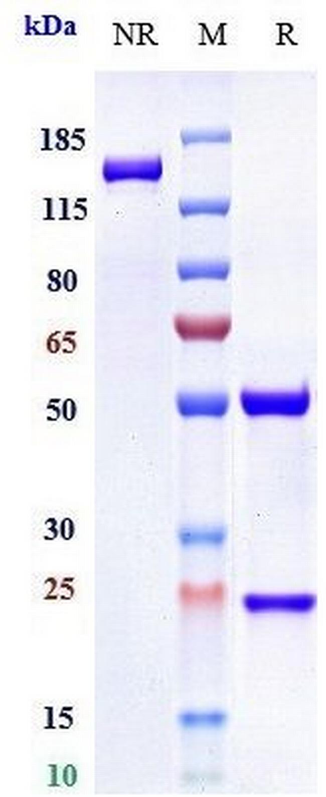 IL-6 (Biosimilar) Antibody in SDS-PAGE (SDS-PAGE)