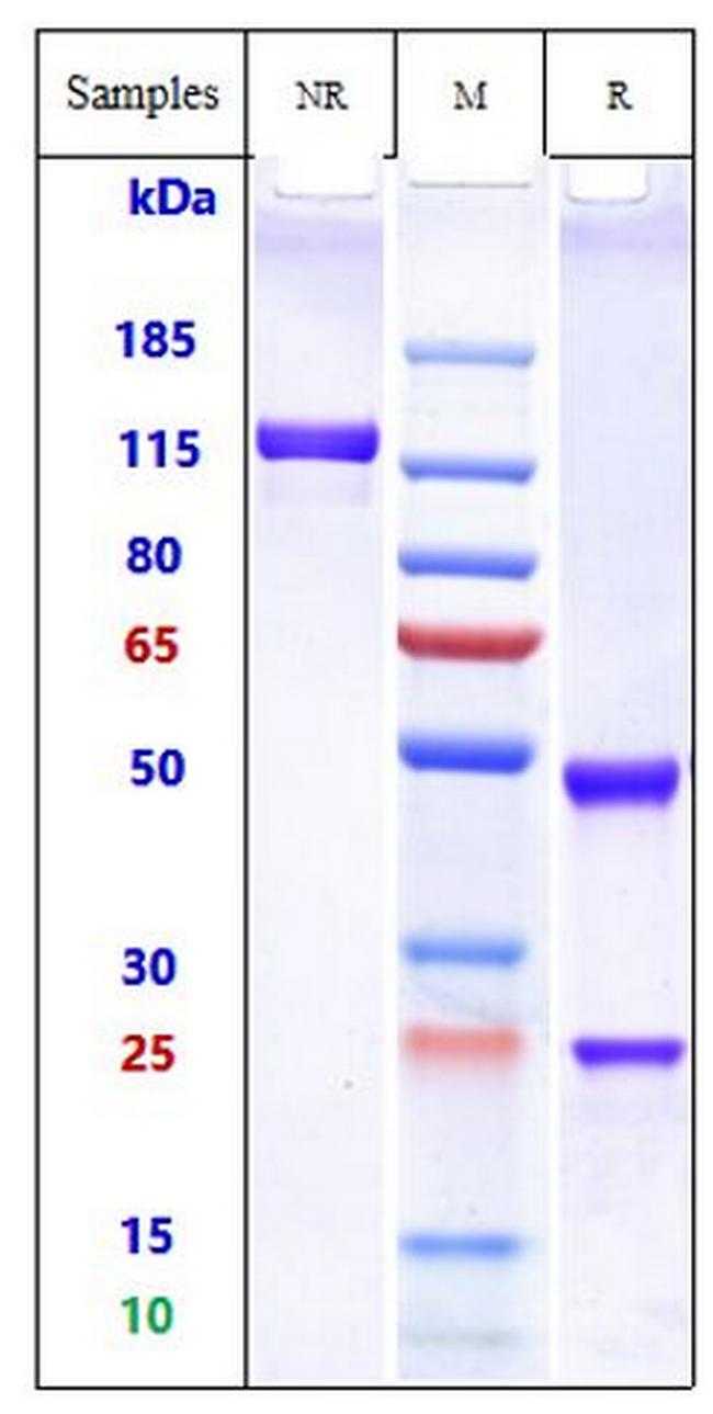 Omalizumab Humanized Antibody in SDS-PAGE (SDS-PAGE)