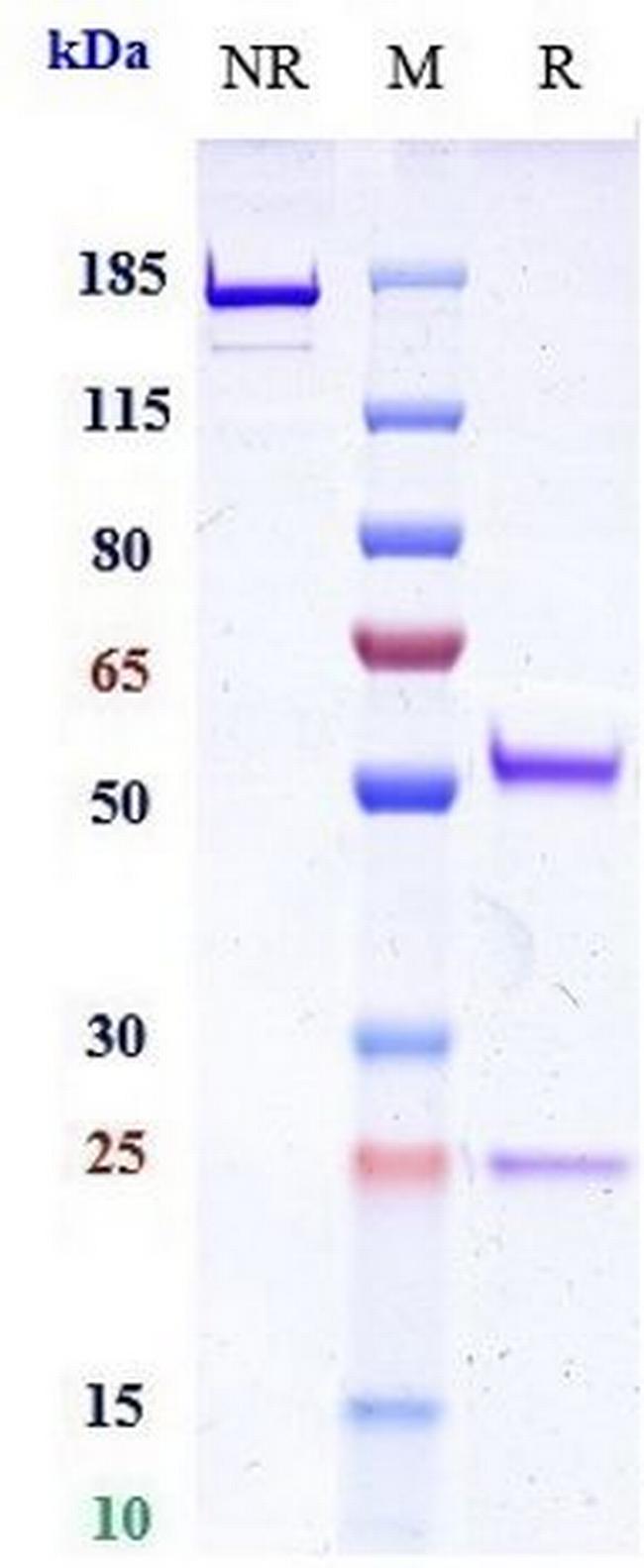 PCSK9 (Ongericimab Biosimilar) Antibody in SDS-PAGE (SDS-PAGE)