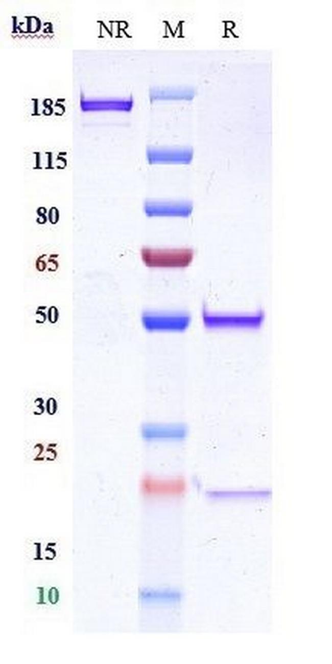 ITGA5/ITGB1 Biosimilar Antibody in SDS-PAGE (SDS-PAGE)