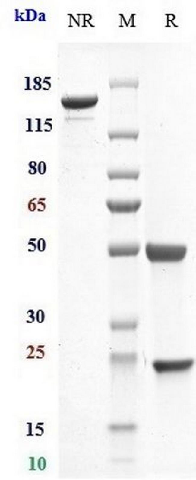 CD11a (Efalizumab Biosimilar) Antibody in SDS-PAGE (SDS-PAGE)