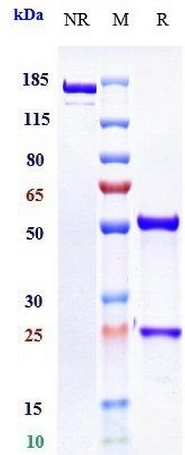 Factor XI (Osocimab Biosimilar) Antibody in SDS-PAGE (SDS-PAGE)