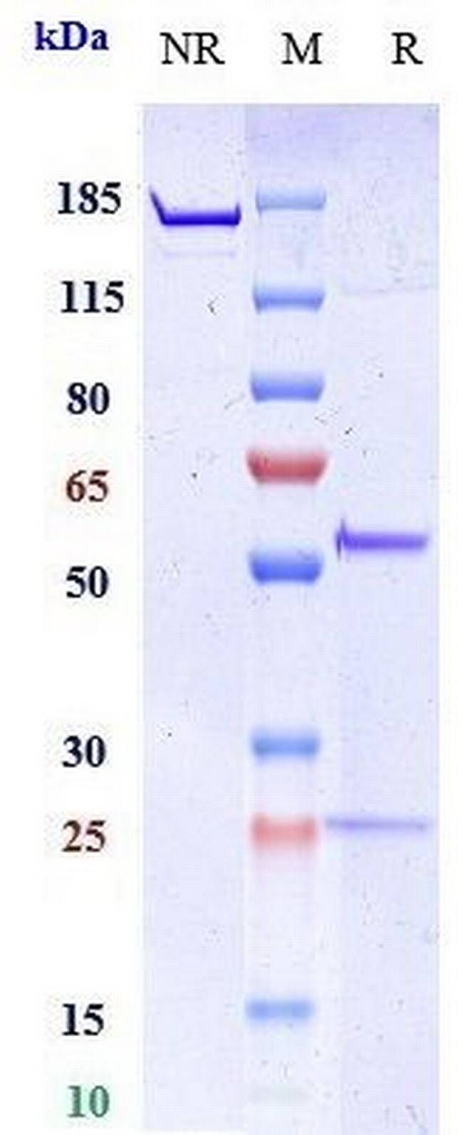 MMP-9 Biosimilar Antibody in SDS-PAGE (SDS-PAGE)