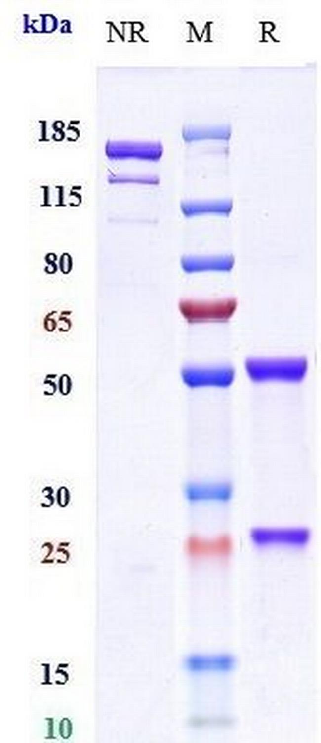 Otelixizumab Humanized Antibody in SDS-PAGE (SDS-PAGE)