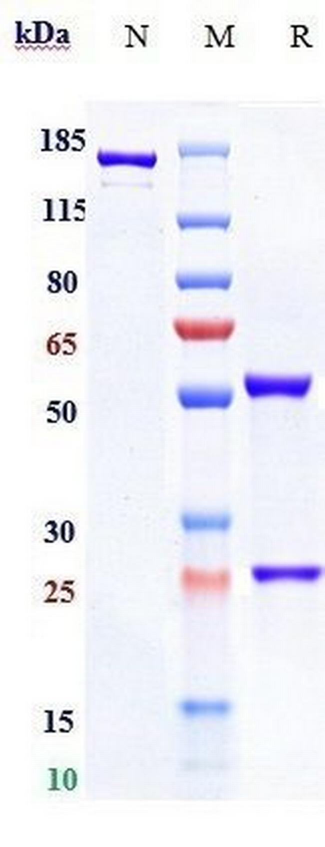NGF Biosimilar Antibody in SDS-PAGE (SDS-PAGE)