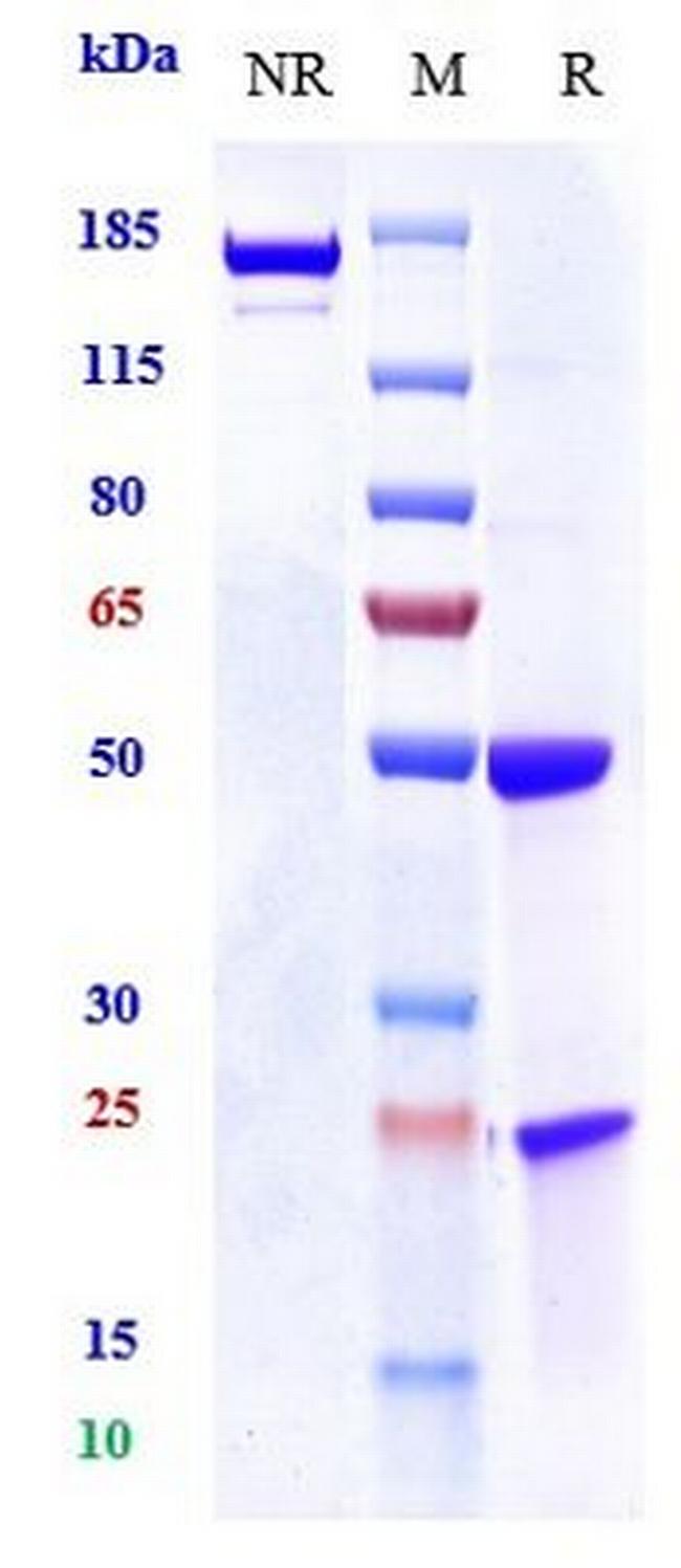 Osteopontin Humanized Biosimilar Antibody in SDS-PAGE (SDS-PAGE)
