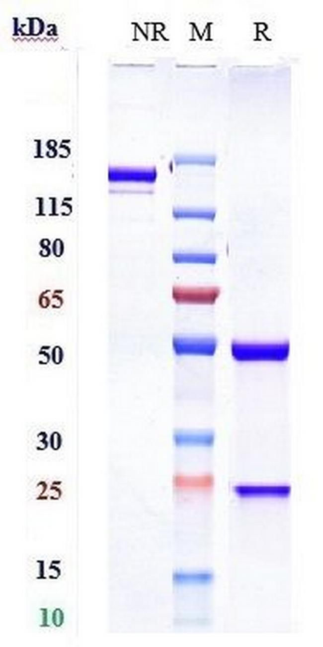 PAR2 Biosimilar Antibody in SDS-PAGE (SDS-PAGE)
