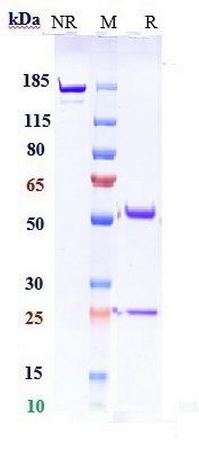 Complement C5 (Pozelimab Biosimilar) Antibody in SDS-PAGE (SDS-PAGE)