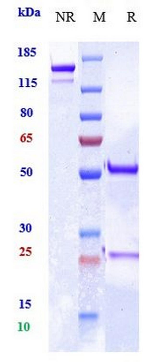 MRC2 (Biosimilar) Antibody in SDS-PAGE (SDS-PAGE)