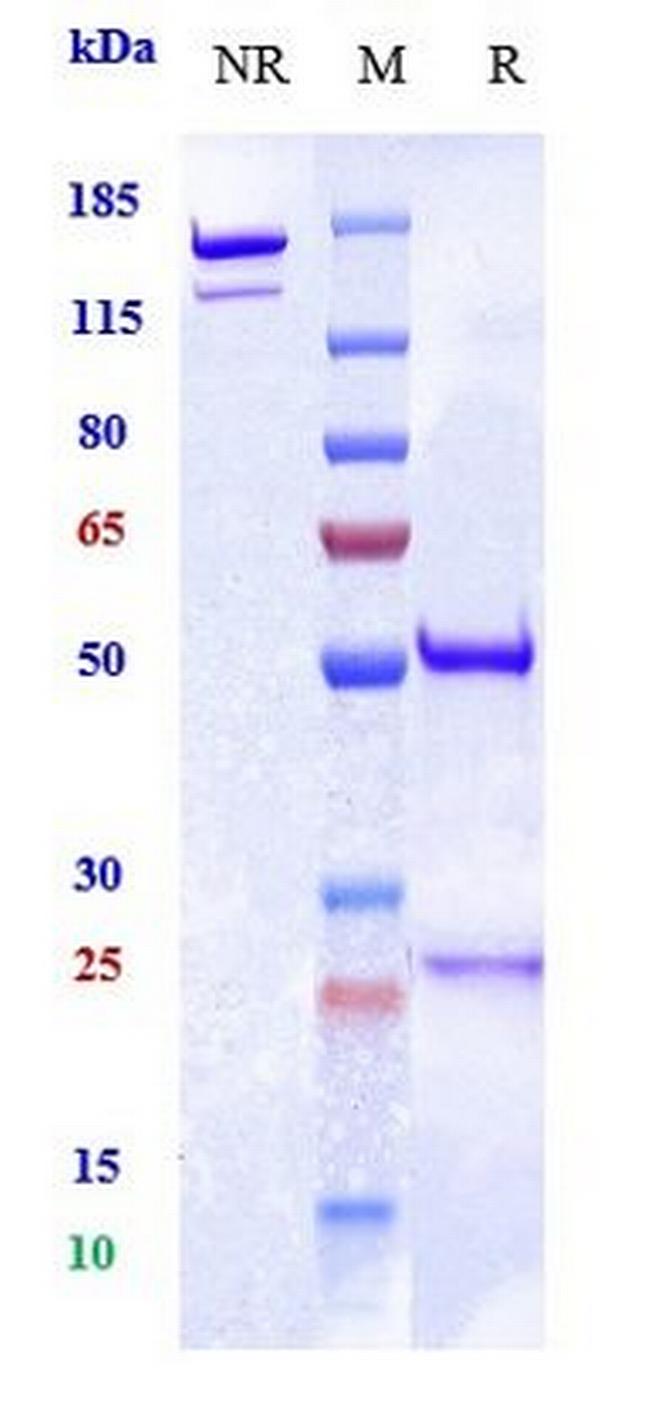PCSK9 (Ralpancizumab Biosimilar) Antibody in SDS-PAGE (SDS-PAGE)