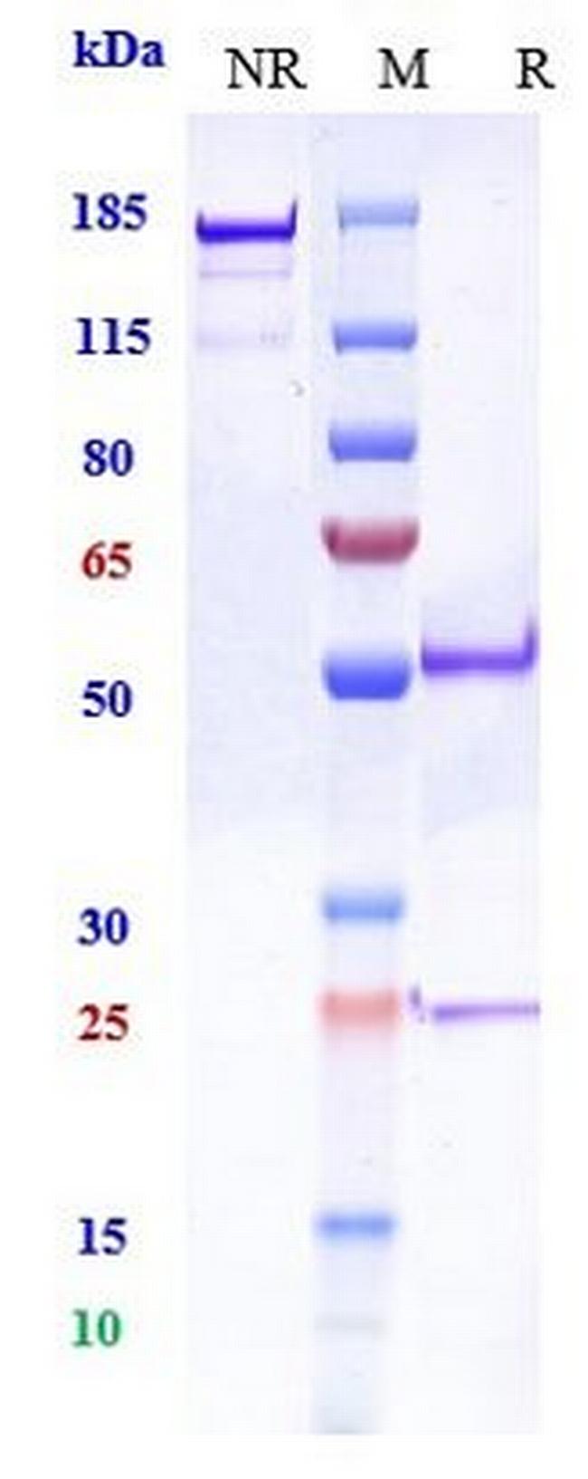 PCSK9 (Biosimilar) Antibody in SDS-PAGE (SDS-PAGE)