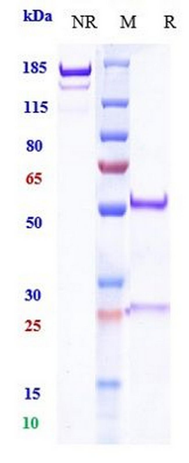 Budigalimab Humanized Antibody in SDS-PAGE (SDS-PAGE)