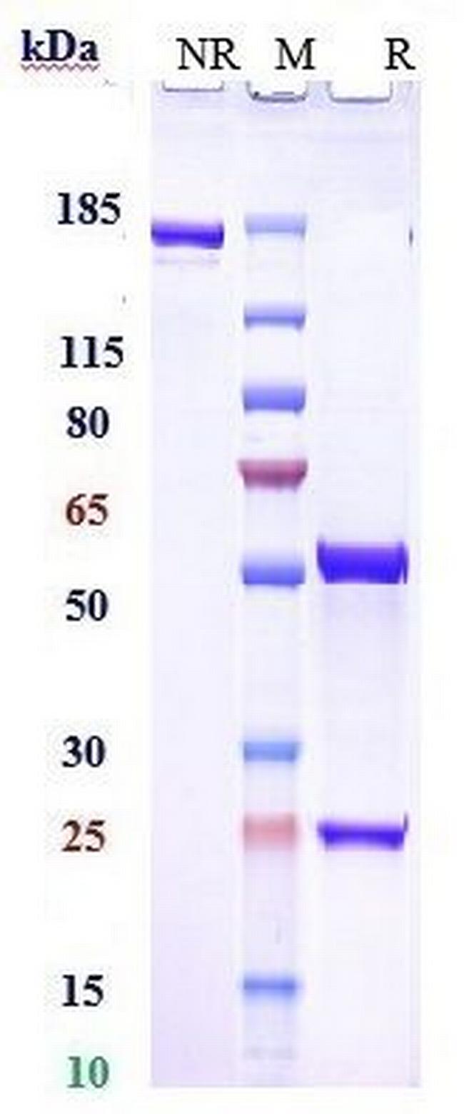 RHD (Roledumab Biosimilar) Antibody in SDS-PAGE (SDS-PAGE)